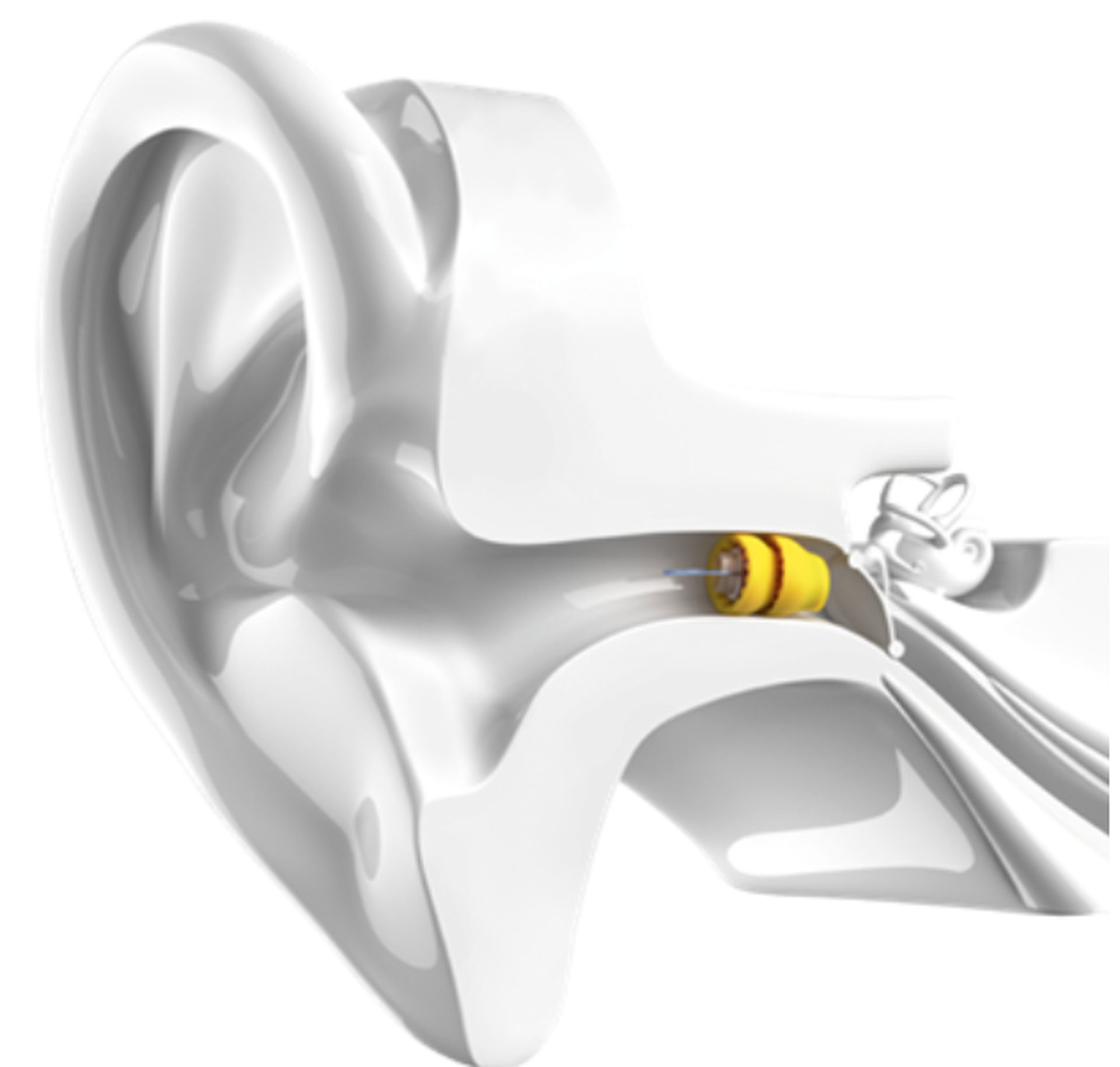Beacon Audiology Hearing Tests Hearing Aids Balance Tests 6233